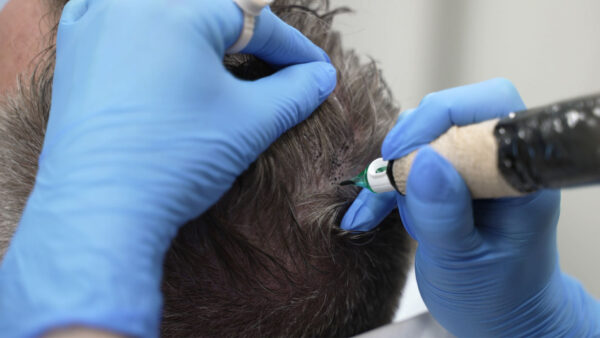 page-header_scalp-micro